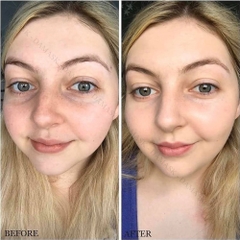 Serum Trị Thâm Mắt The Ordinary Caffeine Solution 5% + EGCG