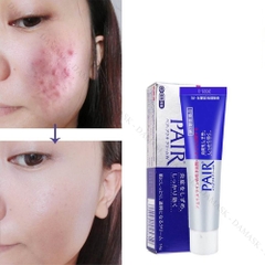 Kem trị mụn Pair Nhật