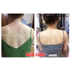 Muối tắm tinh chất sữa non Colostrum Salt Scrub L’asenta