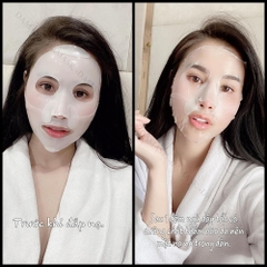 Mặt Nạ Dưỡng Da Hàn Quốc Derm all Matrix Facial Dermal-care Mask
