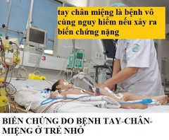 BỆNH TAY CHÂN MIỆNG NGUY HIỂM THẾ NÀO? CÓ CẦN NHẬP VIỆN ĐIỀU TRỊ HAY KHÔNG?