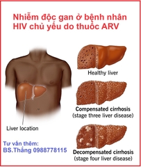 Nguyên nhân nhiễm độc gan ở bệnh nhân HIV