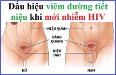 Dấu hiệu viêm đường tiết niệu khi mới nhiễm HIV như thế nào?