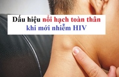 Dấu hiệu nổi hạch toàn thân khi mới nhiễm HIV như thế nào?