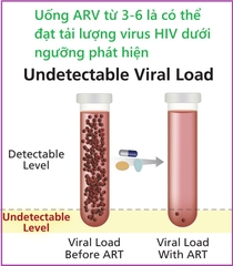 Khi nào đạt tải lượng virus HIV dưới ngưỡng phát hiện? Ý nghĩa thực tiễn?