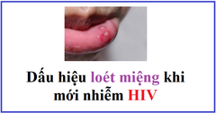 Dấu hiệu loét miệng khi mới nhiễm HIV như thế nào?