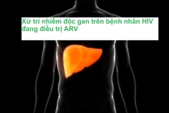 Xử trí nhiễm độc gan trên bệnh nhân HIV đang điều trị ARV