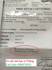 Xét nghiệm đo tải lượng HIV là gì? Cách làm và ý nghĩa thực tiễn?