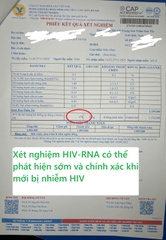 Dùng xét nghiệm đo tải lượng HIV-RNA để phát hiện sớm bị nhiễm HIV