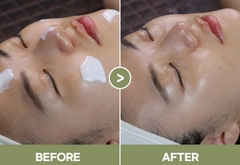 Kem dưỡng ẩm bên trong khô làm dịu da chiết xuất rau má phục hồi da sau điều trị da Medisco Peelieve Cica Cream 2ml*30 gói