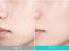 Xà Phòng Rửa Mặt Trị Mụn Và Làm Sạch Mụn Đầu Đen Soonnoc Aqua Cleansing Bar 100g