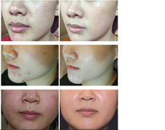 Kem Phục Hồi Da Sau Tổn Thương/ Kem Tái Tạo BB/ Kem Trẻ Hóa Chăm Sóc Da Hàng Ngày/ Làm Trắng/ Cải Thiện Nếp Nhăn/Che Khuyết Điểm/ Chống Tia Cực Tím/ BB Cream/Phấn nước khoáng chất Mineral Cushion Three Days Love Return 10 Recovery Balm 50g