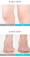 Xà Phòng Rửa Mặt Trị Mụn Và Làm Sạch Mụn Đầu Đen Soonnoc Aqua Cleansing Bar 100g