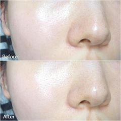 Kem Dưỡng Ẩm Kiềm Dầu Ban Ngày Badecasil Day Cream 23 Years Old 50g