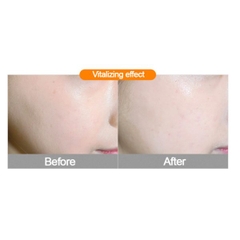 Tinh Chất Vitamin C Dưỡng Trắng Và Trị Thâm Nám Swanicoco Bitamin C Multi Solution Triple V Ampoule 50ml