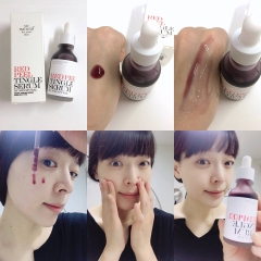 Tinh Chất Peel Da Không Bong Tróc Tái Tạo Da So Natural Red Peel Tingle Serum 35ml