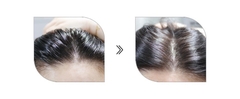 Dầu Gội Dr.Top Scalp Hair Wasabi Shampoo Chống Rụng Tóc Da Đầu Nhạy Cảm Cân Bằng Độ Ph Và 22 Thành Phần Tự Nhiên - 400 Ml