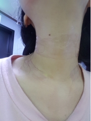 Kem Giảm Và Làm Đầy Nếp Nhăn Dạng Lột Yurica Neck and Line 30ml