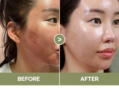 Kem dưỡng ẩm bên trong khô làm dịu da chiết xuất rau má phục hồi da sau điều trị da Medisco Peelieve Cica Cream 2ml*30 gói