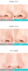 Sữa Rửa Mặt dịu nhẹ làm giảm mụn đậu đen làm sạch bụi mịn Soonnoc Sensitive Cleasing Milk 200ml
