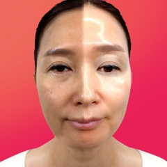 Mặt nạ collagen làm sáng da và làm săn chắc phục hồi căng bóng da Stayve Medisco Skin Glow Mask