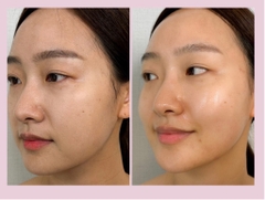 Mặt nạ collagen làm sáng da và làm săn chắc phục hồi căng bóng da Stayve Medisco Skin Glow Mask