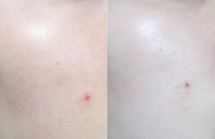 Kem Dưỡng Trắng Tái Tạo Da Dr.Jart+ V7 Toning Light New 50ml