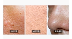 Tinh chất se khít lỗ chân lông đàn hồi da Doobom MTS Pore Ampoule 15ml