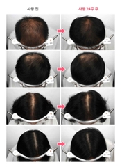 Dầu gội trị rụng tóc RGIII Hair Loss Clinic Shampoo 520ml