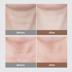 Kem dưỡng cổ chuyên sâu xoá nhăn da và nâng cơ da vùng cổ Nature One Intensive Neck Cream 50g Neck Wrinkle Elasticity Lifting