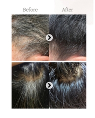 Thuốc nhuộm tóc phủ bạc bằng nước thuần chay không hại da đầu Man with Flowers Seoritae Vegan Hair Dye Gray Cover Mild Dye With Water (Đen tự nhiên/Nâu)