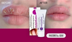 Son Dưỡng Môi Trị Khô Môi/ Chăm sóc tế bào chết môi/ trị mụn rộp môi Herpetino Lip Balm 10ml