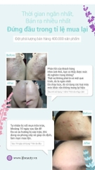 Xà Phòng Rửa Mặt Trị Mụn Và Làm Sạch Mụn Đầu Đen Soonnoc Aqua Cleansing Bar 100g