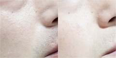Sữa rửa mặt Ulos Face Wash For Skincare dành cho nam để loại bỏ mụn đậu đen chăm sóc da