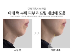 Kem dưỡng cổ Loại lăn chống nhăn nâng cơ chống lão hóa Lizk Neck Cream 50g