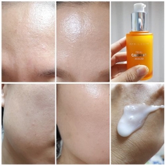 Tinh Chất Trị Mụn Phục Hồi Sáng Da Sau Mụn Chiết Xuất Cà Rốt April Skin Real Carrot Blemish Clear Serum 45g