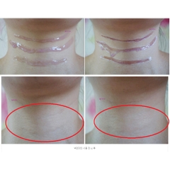 Kem Giảm Và Làm Đầy Nếp Nhăn Dạng Lột Yurica Neck and Line 30ml