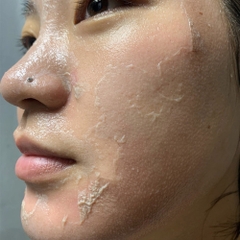 Bột peel da tẩy tế bào chết da Medisco Peelieve Peeling Herbal Peeling Seaweed Facial Exfoliation Powder 1g + Solution 8ml (1 set)