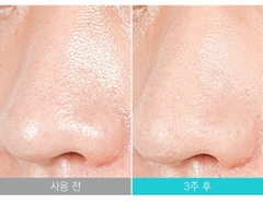 Xà Phòng Rửa Mặt Trị Mụn Và Làm Sạch Mụn Đầu Đen Soonnoc Aqua Cleansing Bar 100g