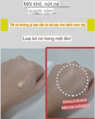 Son Dưỡng Môi Trị Khô Môi/ Chăm sóc tế bào chết môi/ trị mụn rộp môi Herpetino Lip Balm 10ml