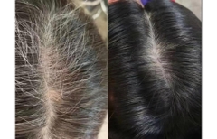 Dầu gội nhuộm đổi màu tóc bạc chứa 1 tỷ vi khuẩn có lợi axit lactic chăm sóc da đầu và tóc chắc khỏe SMIB Lactobio Color Change Hair Dye Shampoo (có tác dụng làm giảm các triệu chứng rụng tóc) 200ml