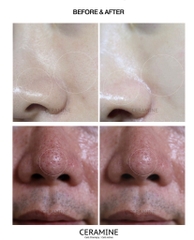 Tẩy tế bào chết CERAMINE Botanical O2 Peeling Gel Tẩy tế bào chết dành cả da nhạy cảm mọi đối tượng kể cả bà bầu