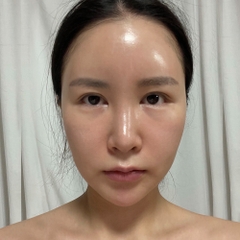 Bộ sản phẩm Peel da cao cấp mỹ phẩm thẩm mỹ chứa Spicule Stayve Seanergy Peel Ampoule