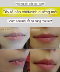 Son Dưỡng Môi Trị Khô Môi/ Chăm sóc tế bào chết môi/ trị mụn rộp môi Herpetino Lip Balm 10ml