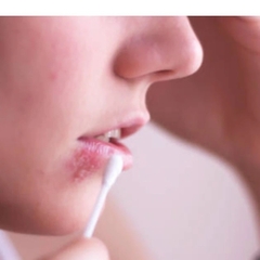 Son Dưỡng Môi Trị Khô Môi/ Chăm sóc tế bào chết môi/ trị mụn rộp môi Herpetino Lip Balm 10ml