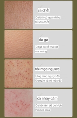 Kem dưỡng phục hồi các vấn đề về da da gà/ dày sừng / lông mọc ngược / viêm nang lông ATOBK Pore & Bumpy skin repair lotion