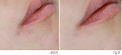 Gel Trị Mụn Viêm Đỏ Chiết Xuất Rau Má Hanyul Mentha Trouble Spot Gel 20ml