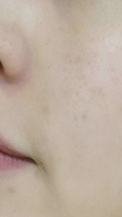 Phấn Nước Dưỡng Da Trang Điểm Thiên Nhiên Dr.Althea Aurora Cover Cushion SPF50+/ PA +++ 15gx2ea