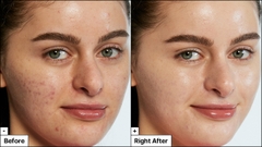 Kem cica làm đều màu da vết đỏ da mụn da nhạy cảm làm dịu da dễ kích ứng Dr.Jart+Cicapair Tiger Grass Color Correcting Treatment SPF22 PA++ 50ml