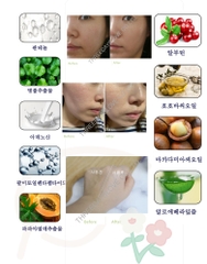 Phấn nước khoáng chất trang điểm chống nắng sau điều trị da liễu / Kem Phục Hồi Da Sau Tổn Thương/ Kem Tái Tạo BB/ Kem Trẻ Hóa Chăm Sóc Da Hàng Ngày/ Làm Trắng/ Cải Thiện Nếp Nhăn/Che Khuyết Điểm/ Chống Tia Cực Tím/ BB Cream/ Mineral Cushion Three Days Love Return 10 Recovery Balm (tùy chọn 3 dung tích)